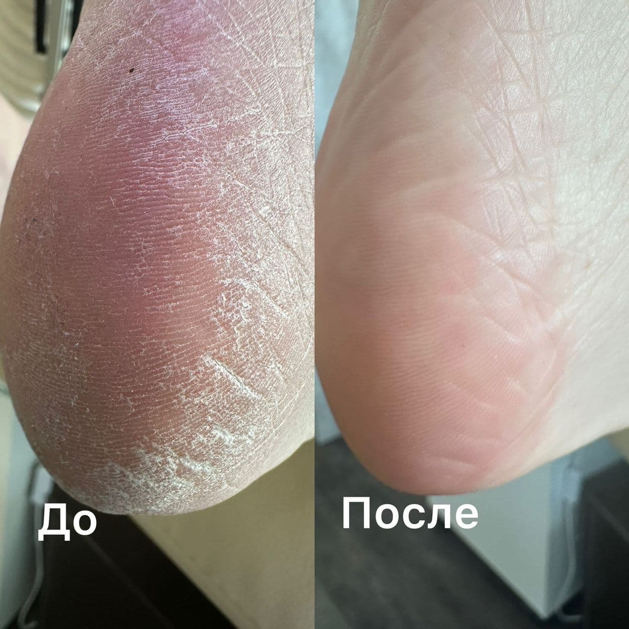 Купить Базовый курс "Полный педикюр с покрытием гель-лак"