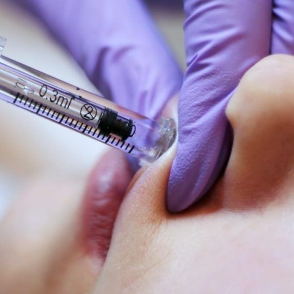 Купить Курс "Hyarylon Pen"