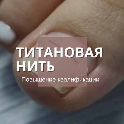 Купить Титановая нить